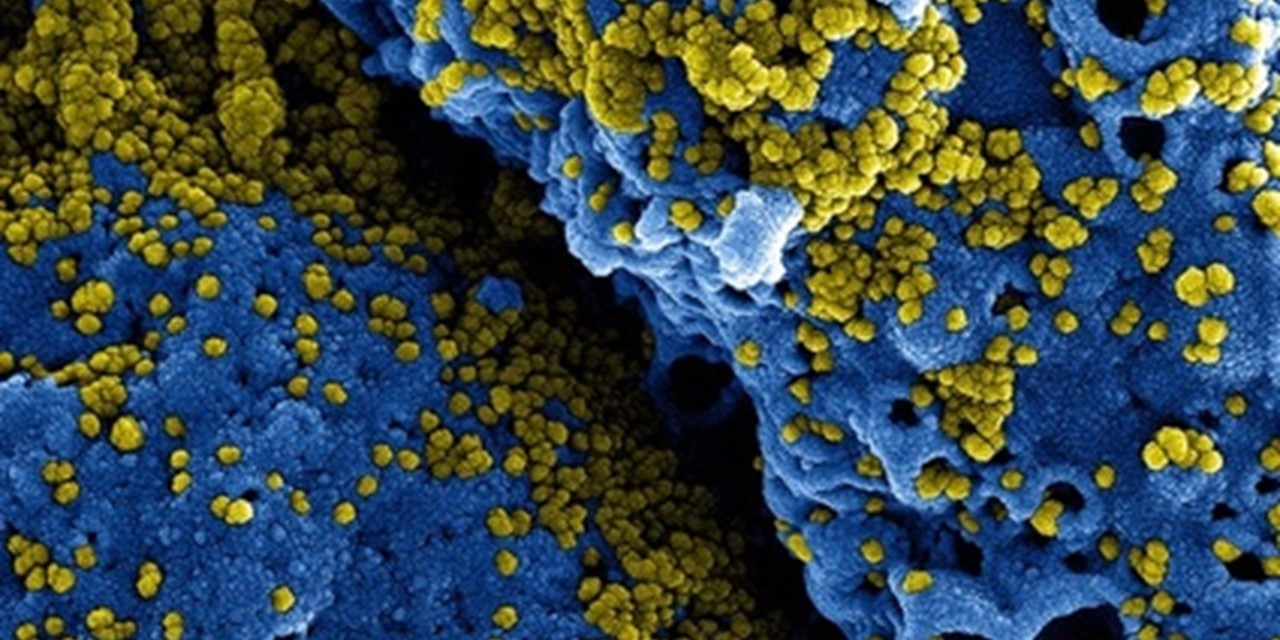 Coronavirus